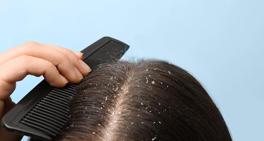 Types of Hair Treatment in Spa
