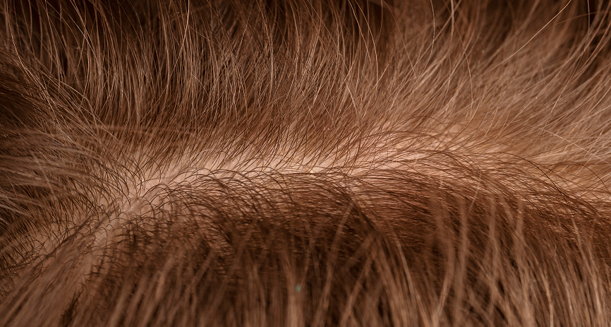 Head Massage Benefits - Healthier Scalp and Sebum Balance