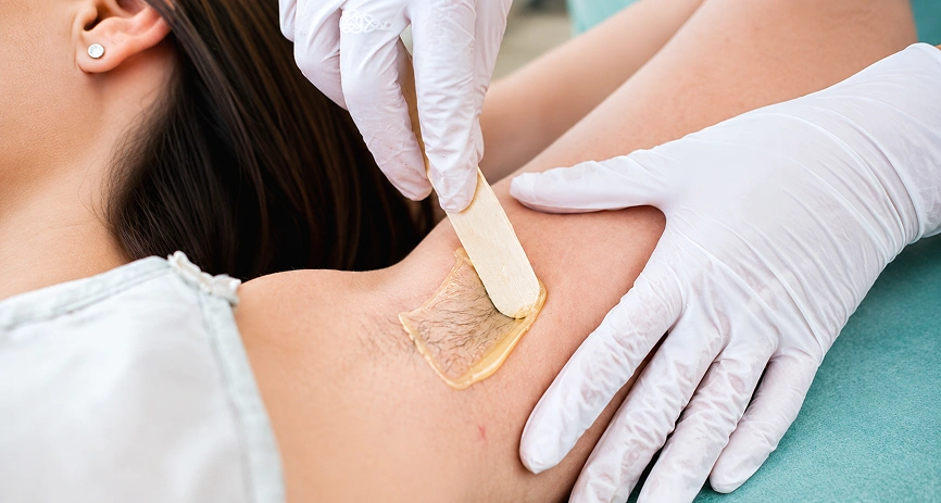 Waxing or Laser Hair Removal
